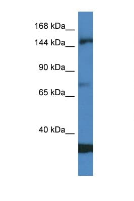 Polyclonal Rabbit anti-Human EIF5B / IF2 Antibody (aa557-606, WB)