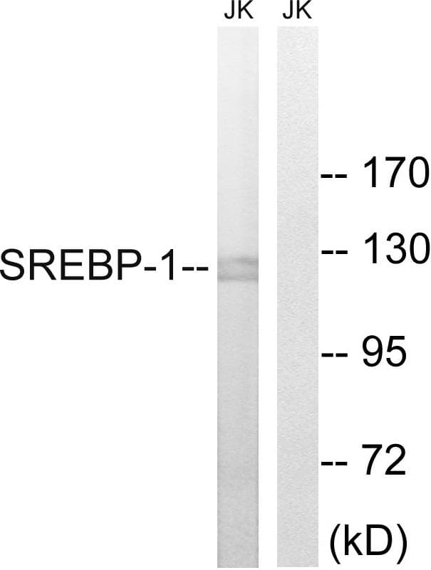 Polyclonal Rabbit anti-Human SREBF1 / SREBP-1 Antibody (p439, WB)