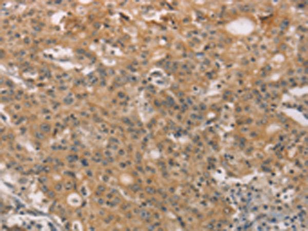 Polyclonal Rabbit anti-Human ZADH2 Antibody (IHC)
