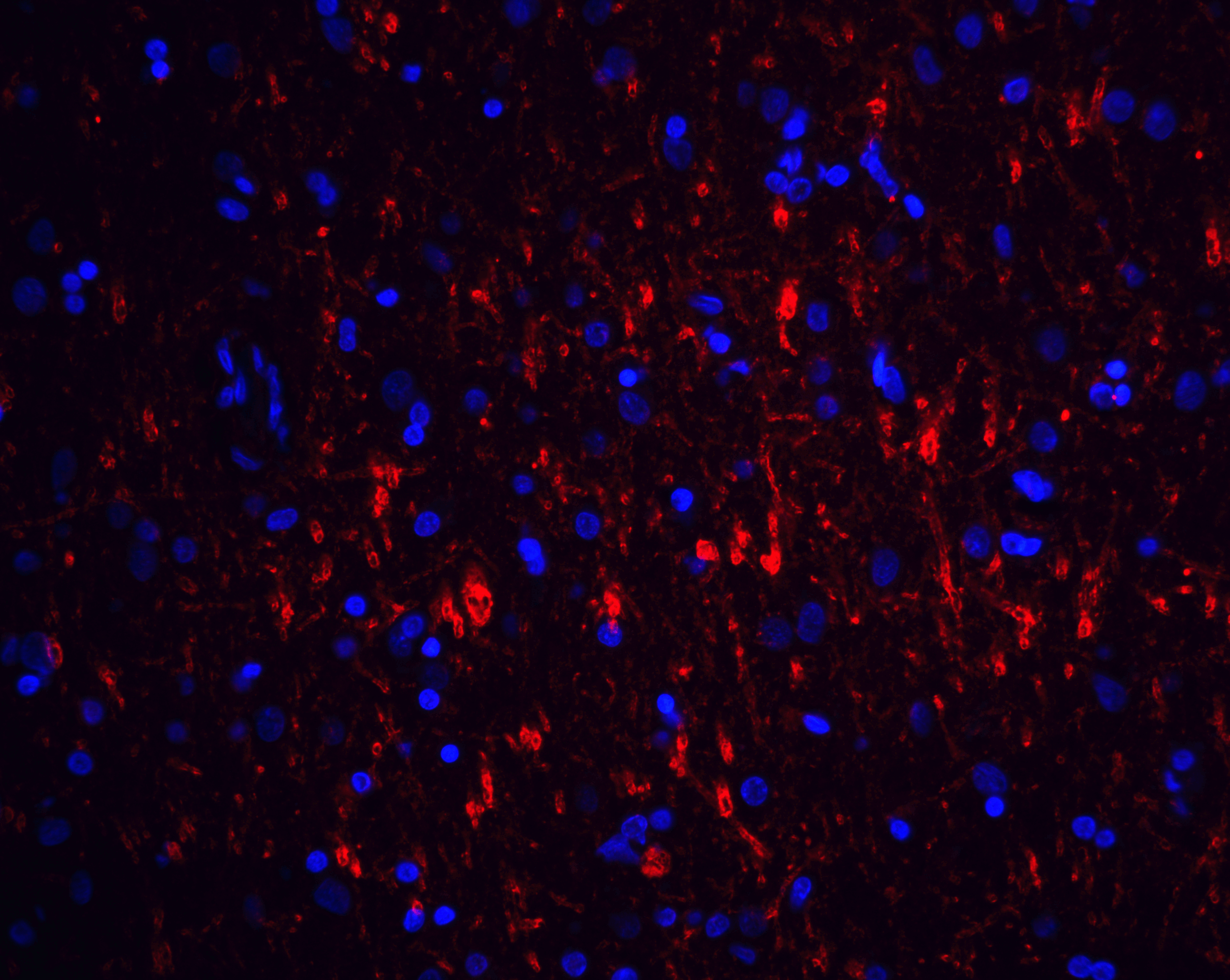 GFRA1 / GFR Alpha Antibody