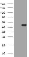 TOP2A / Topoisomerase II Alpha Antibody (aa1100-1531, clone OTI3E11)