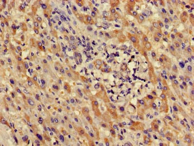 LDHD / Lactate Dehydrogenase D Antibody