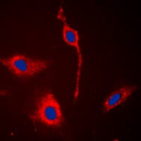 IHC-plus™ EPHA6 / EPH Receptor A6 Antibody (C-Terminus)