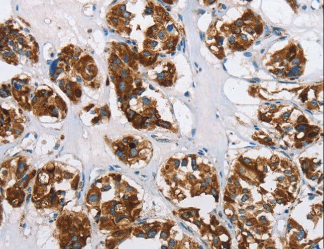 Polyclonal Rabbit anti-Human HINT2 Antibody (IHC, WB)