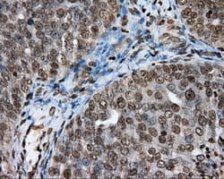 DAPK2 / DAP Kinase 2 Antibody (clone OTI1F7, Carrier-free)