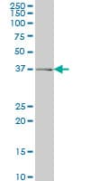 Monoclonal Mouse anti-Human ADH6 Antibody (clone 4G4, WB)