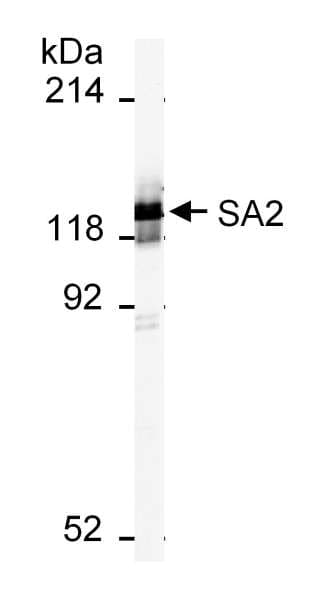 IHC-plus™ STAG2 Antibody (aa1125-1175)