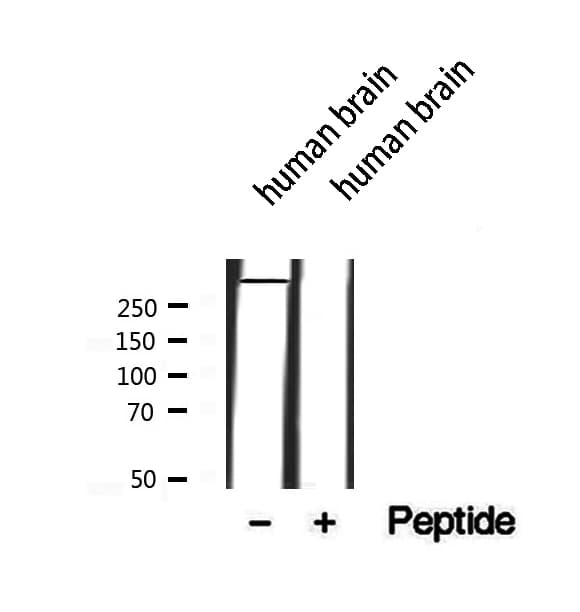 MAP1B Antibody