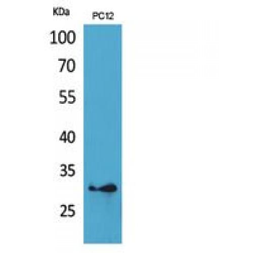 HLA-DQB1 + HLA-DQB2 Antibody (131-180 aa, Internal)