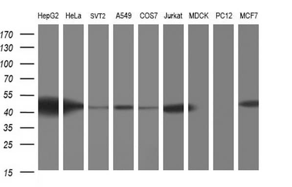 TXNDC5 / ERP46 Antibody (clone OTI1C3)