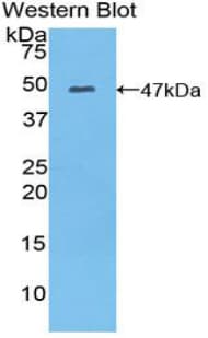 MYL6B Antibody (aa6-137)