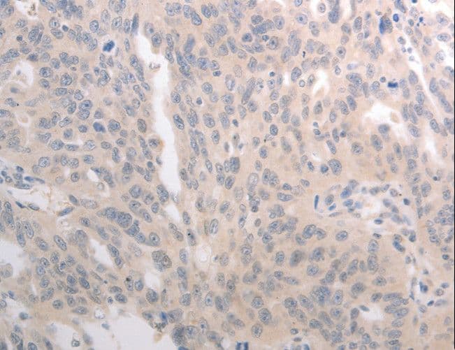 CD275 / B7-H2 / ICOS Ligand Antibody
