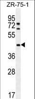 METTL2B Antibody (aa329-359)