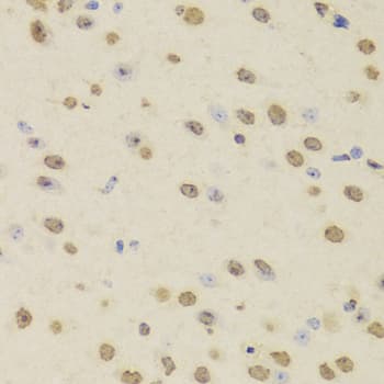 Polyclonal Rabbit anti-Human HNRNPD / AUF1 Antibody (IHC, WB)