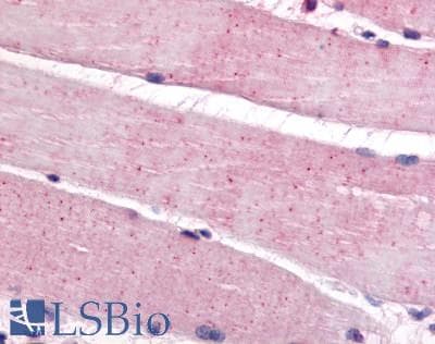IHC-plus™ Polyclonal Rabbit anti-Human VMD2L3 / BEST3 Antibody (C-Terminus, IHC)