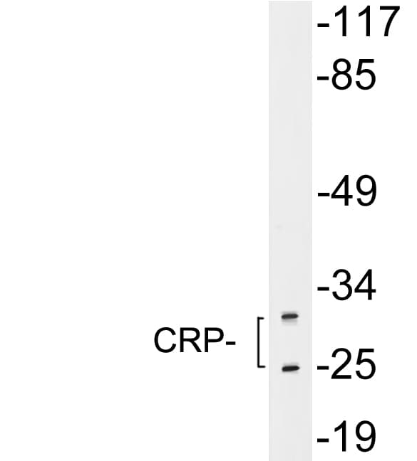 CRP / C-Reactive Protein Antibody (aa94-143)