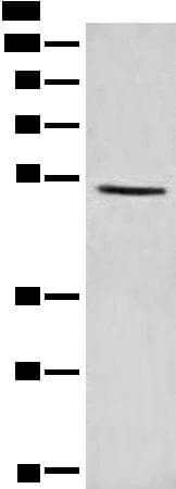 Polyclonal Rabbit anti-Human PTEN Antibody (IHC, WB)