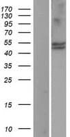 Human CYP11B1 Protein (Over-Expression Lysate Myc-DDK (Flag))