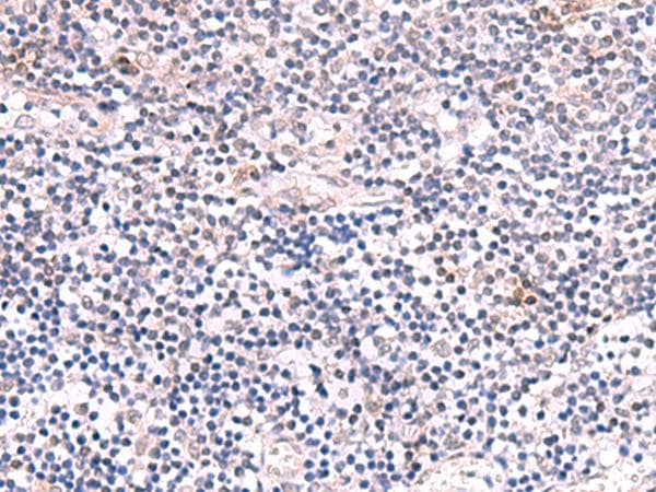 INPP5K / SKIP Antibody