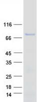 Human FOXO1 / FKHR Protein (Recombinant Myc-DDK (Flag))