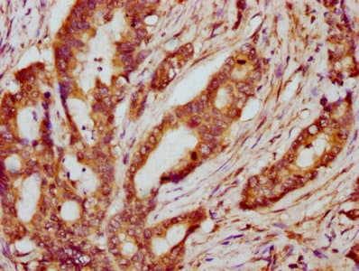 PPP2R2B Antibody