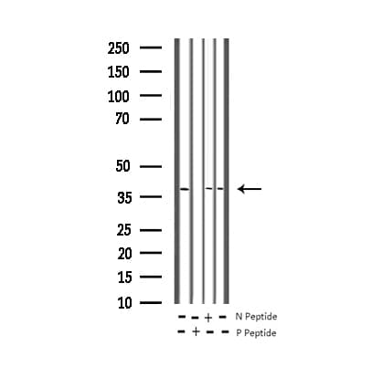 Polyclonal Rabbit anti-Human JUN / c-Jun Antibody (phospho-Thr91, IHC, WB)