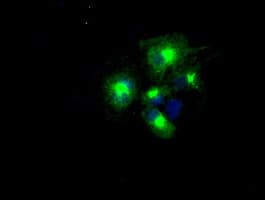 APP / Beta Amyloid Precursor Antibody (clone OTI5F1)