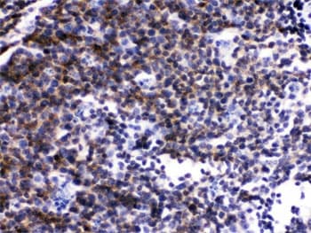Polyclonal Rabbit anti-Human p56lck / LCK Antibody (IHC, WB)