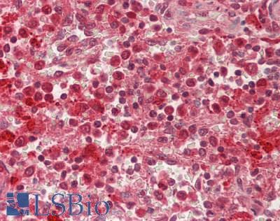 IHC-plus™ VNN1 Antibody (clone 4E11)