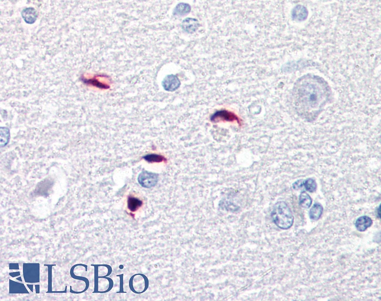 IHC-plus™ GLI / GLI1 Antibody (aa940-990)