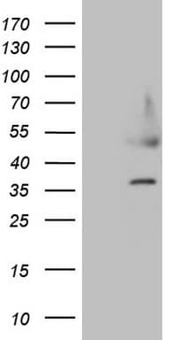 Monoclonal Mouse anti-Human HDGF Antibody (clone OTI8C7, Carrier-free, WB)