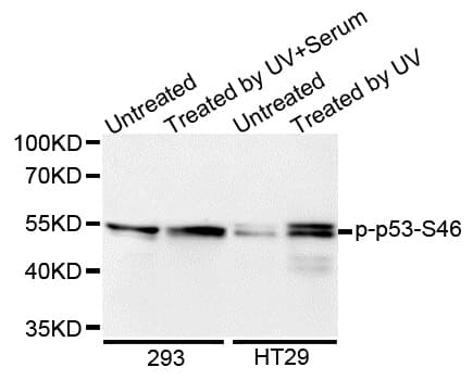 TP53 / p53 Antibody (phospho-Ser46)