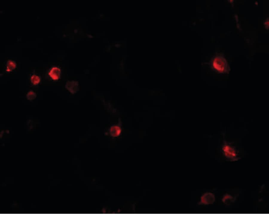 IHC-plus™ Polyclonal Rabbit anti-Human USP10 Antibody (IHC, IF, WB)