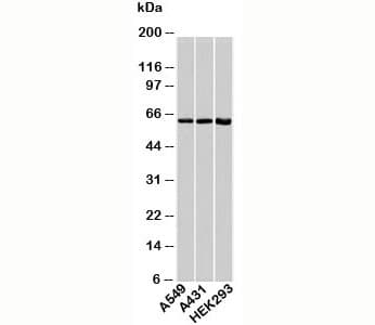 Polyclonal Rabbit anti-Human HSPD1 / HSP60 Antibody (WB)