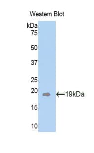 PLXNB1 / Plexin-B1 Antibody (aa581-727)