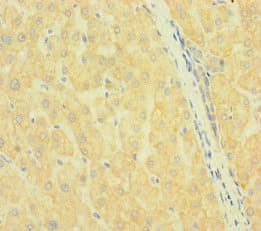 Polyclonal Rabbit anti-Human SLC38A9 Antibody (IHC, IF, WB)