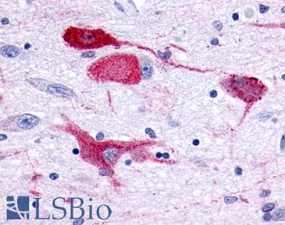 PathPlus™ GPR83 Antibody (Extracellular Domain)