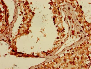 IHC-plus™ FKBP38 / FKBP8 Antibody