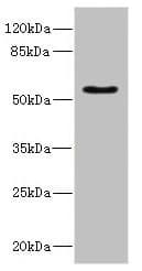Polyclonal Rabbit anti-Human CALCR / Calcitonin Receptor Antibody (IHC, WB)