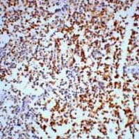 Monoclonal Mouse anti-Human ENO2 / NSE Antibody (IHC, WB)