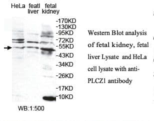 PLCZ1 Antibody (aa322-572)