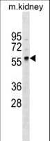 GALNT11 Antibody (aa110-138)