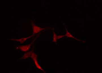 Polyclonal Rabbit anti-Human PRKACG Antibody (IF, WB)