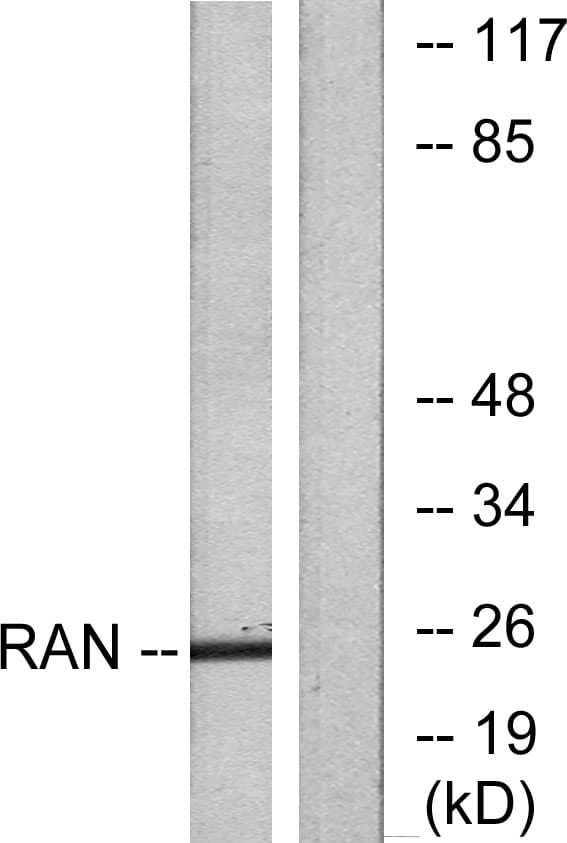 IHC-plus™ RAN Antibody (aa167-216)