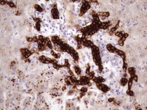 KRT16 / CK16 / Cytokeratin 16 Antibody (clone OTI1G5)