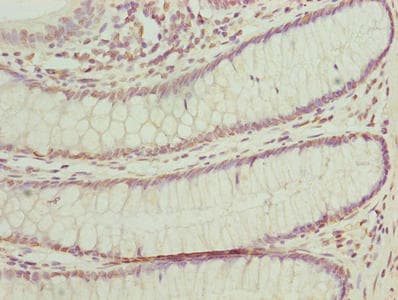 BUD31 Antibody