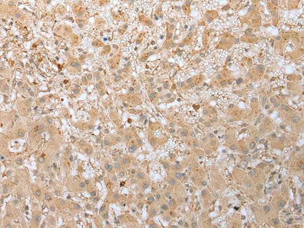 Polyclonal Rabbit anti-Human FAD104 / FNDC3B Antibody (IHC)