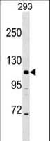 AP3B2 Antibody (aa16-44)