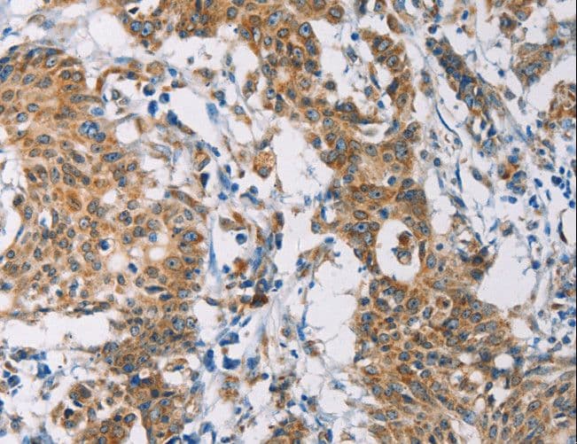 Ceramide Kinase / CERK Antibody