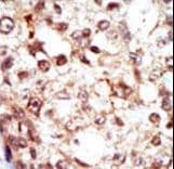 FGR Antibody (aa3-33)